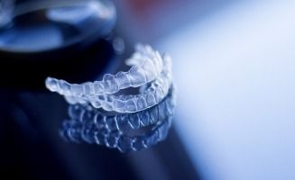 Two clear aligners resting on table
