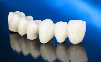 Dental bridge against dark blue background