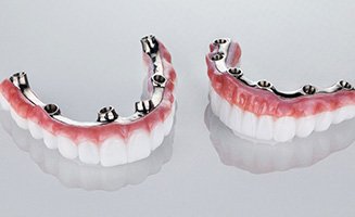 A pair of implant dentures