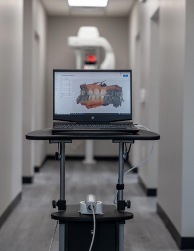 Digital impressions of teeth on computer screen in dental office hallway