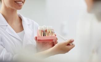 Dentist showing a patient a dental implant model