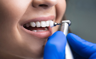 Close up of woman having her teeth cleaned by Edison dentist