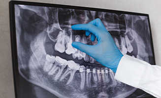 Dentist gesturing toward a tooth on screen showing digital dental x rays