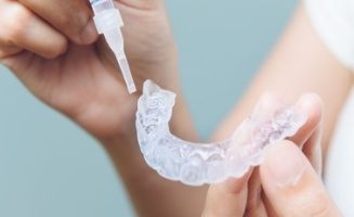 Person putting teeth whitening gel into tray