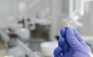 Dentist holding an extracted tooth in gloved hand