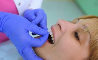 Dentist fitting a woman's tooth with a veneer
