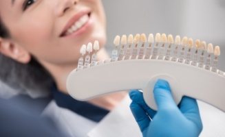 Dentist holding shade guide to patient's smile